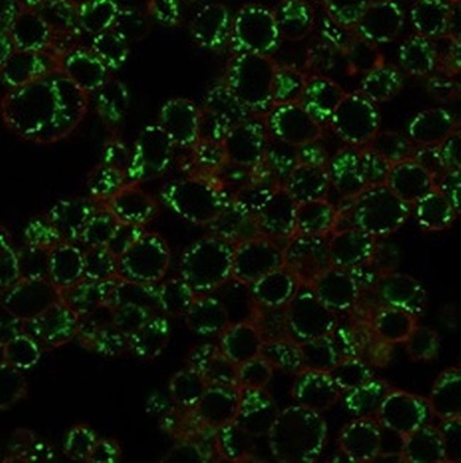 EZH2/KMT6 Antibody in Immunocytochemistry (ICC/IF)