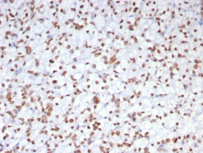 EZH2/KMT6 Antibody in Immunohistochemistry (Paraffin) (IHC (P))