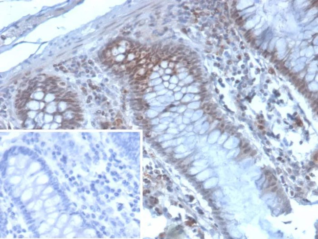 EZH2/KMT6 Antibody in Immunohistochemistry (Paraffin) (IHC (P))