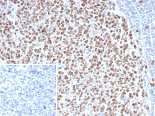 EZH2/KMT6 Antibody in Immunohistochemistry (Paraffin) (IHC (P))