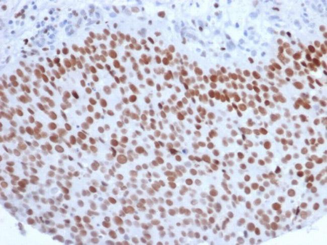 EZH2/KMT6 Antibody in Immunohistochemistry (Paraffin) (IHC (P))