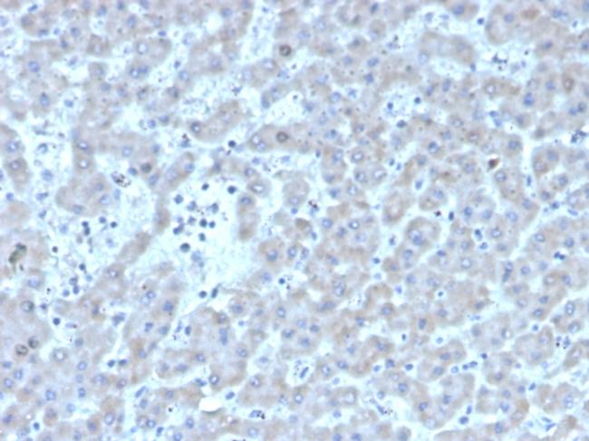 Coagulation Factor VII/F7 Antibody in Immunohistochemistry (Paraffin) (IHC (P))