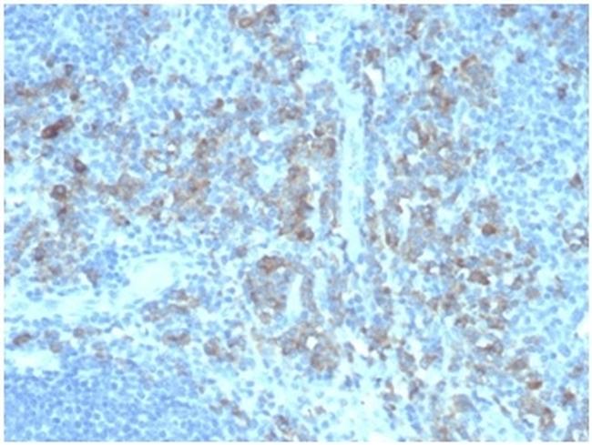 ALDH1A1 (Aldehyde Dehydrogenase 1A1) Antibody in Immunohistochemistry (Paraffin) (IHC (P))