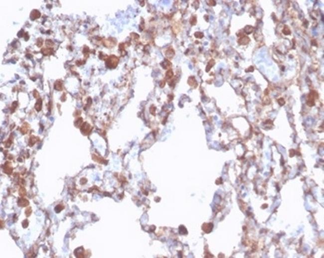 ALDH1A1 (Aldehyde Dehydrogenase 1A1) Antibody in Immunohistochemistry (Paraffin) (IHC (P))