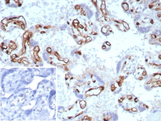 Fatty Acid Binding Protein 4 (FABP4) Antibody in Immunohistochemistry (Paraffin) (IHC (P))