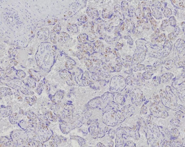 Fatty Acid Binding Protein 4 (FABP4) Antibody in Immunohistochemistry (Paraffin) (IHC (P))