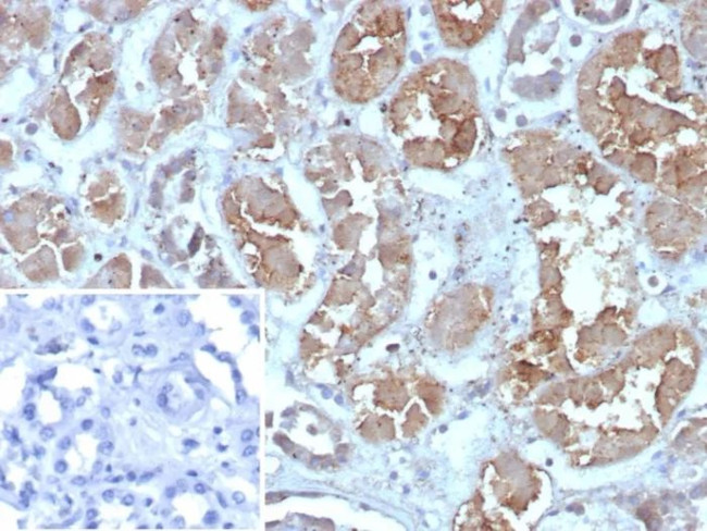 Fatty Acid Binding Protein (Liver)/FABP1 Antibody in Immunohistochemistry (Paraffin) (IHC (P))