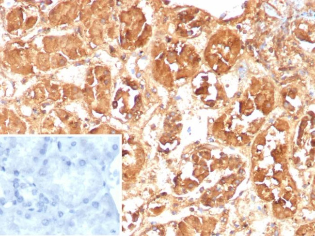 Fatty Acid Binding Protein (Liver)/FABP1 Antibody in Immunohistochemistry (Paraffin) (IHC (P))