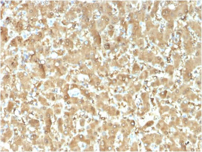 Fatty Acid Binding Protein (Liver)/FABP1 Antibody in Immunohistochemistry (Paraffin) (IHC (P))