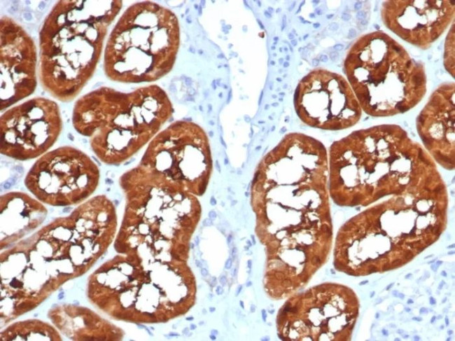 Fatty Acid Binding Protein (Liver)/FABP1 Antibody in Immunohistochemistry (Paraffin) (IHC (P))