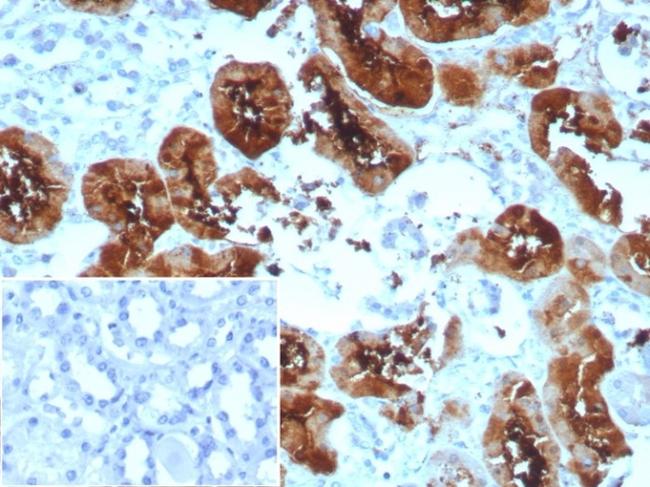 Fatty Acid Binding Protein (Liver)/FABP1 Antibody in Immunohistochemistry (Paraffin) (IHC (P))