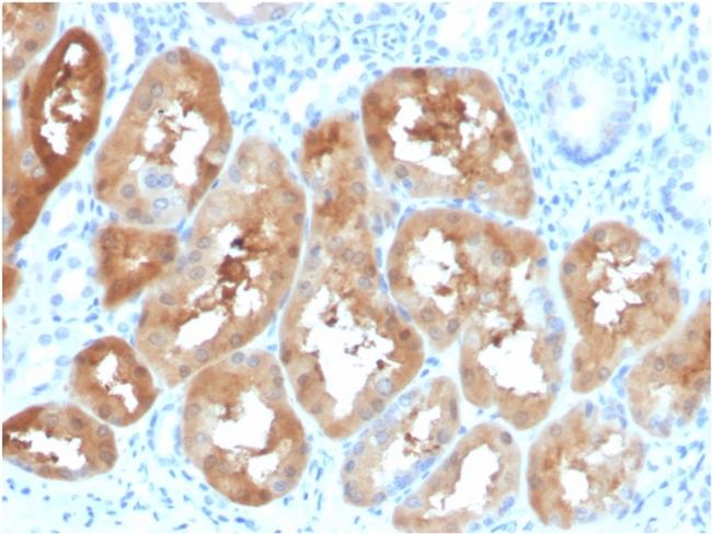 Fatty Acid Binding Protein (Liver)/FABP1 Antibody in Immunohistochemistry (Paraffin) (IHC (P))