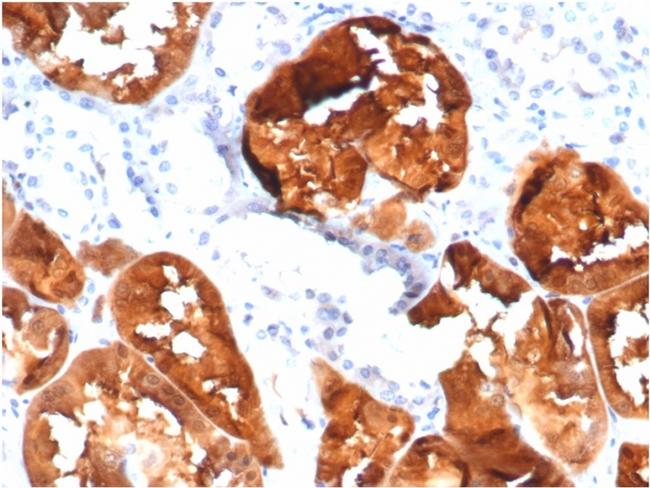 Fatty Acid Binding Protein (Liver)/FABP1 Antibody in Immunohistochemistry (Paraffin) (IHC (P))