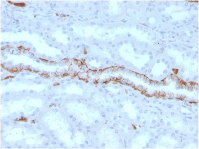 Fatty Acid Binding Protein (Liver)/FABP1 Antibody in Immunohistochemistry (Paraffin) (IHC (P))