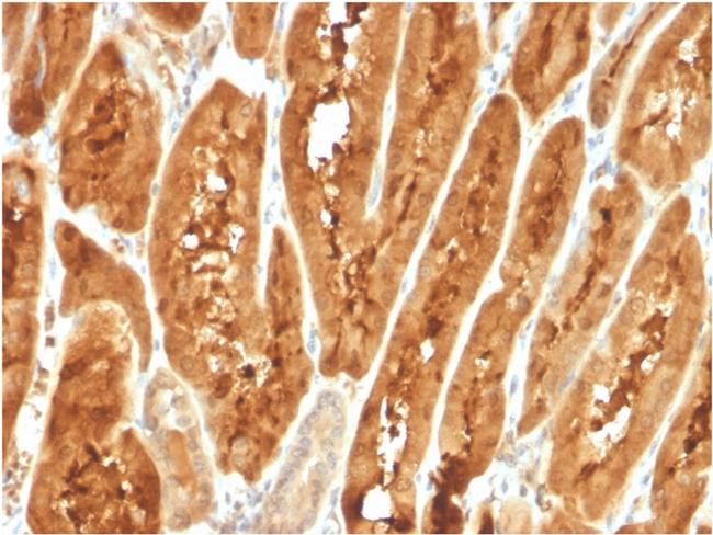 Fatty Acid Binding Protein (Liver)/FABP1 Antibody in Immunohistochemistry (Paraffin) (IHC (P))