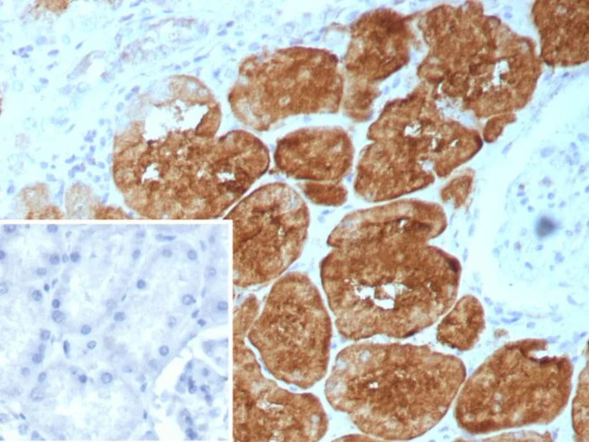 Fatty Acid Binding Protein (Liver)/FABP1 Antibody in Immunohistochemistry (Paraffin) (IHC (P))