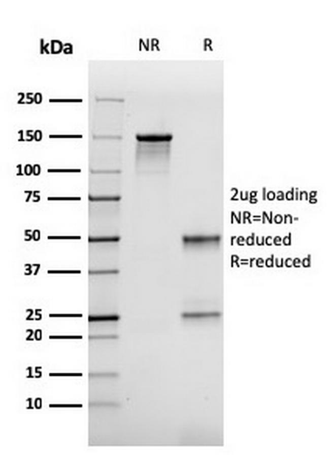 FABP2 (Marker of Metastatic Potential in Colorectal Cancer) Antibody in SDS-PAGE (SDS-PAGE)