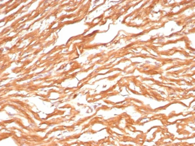 Heart Fatty Acid Binding Protein (H-FABP)/FABP3 Antibody in Immunohistochemistry (Paraffin) (IHC (P))