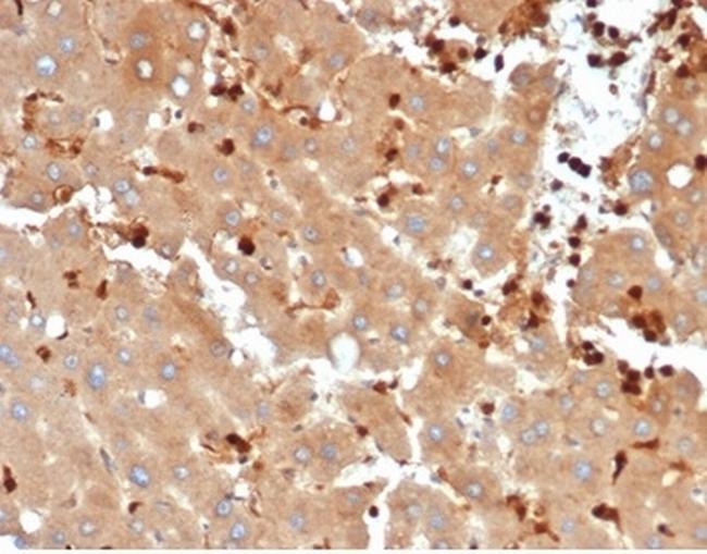 FABP5 (Marker of Metastatic Potential in Colorectal Cancer) Antibody in Immunohistochemistry (Paraffin) (IHC (P))