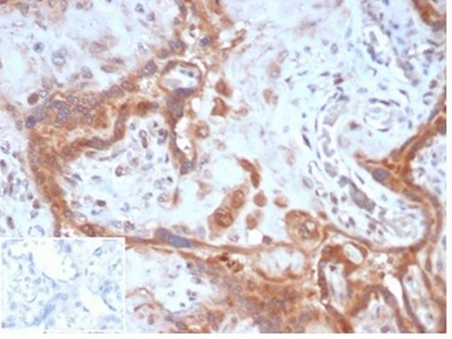 Fibroblast Activation Protein Alpha/FAP-1 Antibody in Immunohistochemistry (Paraffin) (IHC (P))