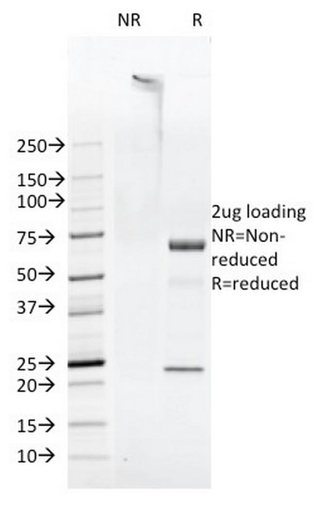 FAT1 (FAT atypical cadherin 1) Antibody in SDS-PAGE (SDS-PAGE)