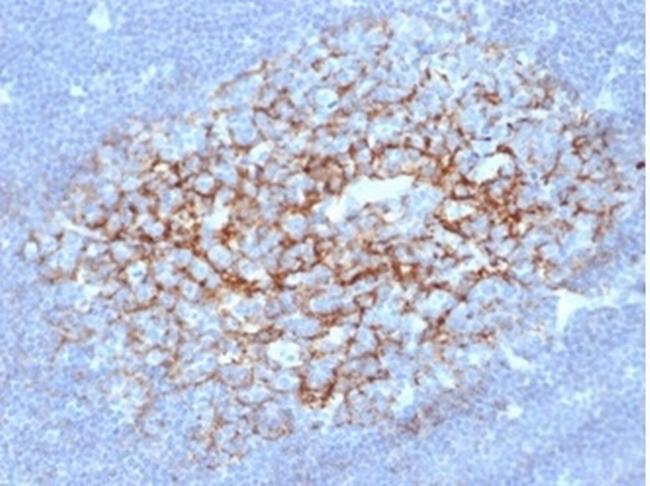 CD23 (Fc Epsilon RII) Antibody in Immunohistochemistry (Paraffin) (IHC (P))