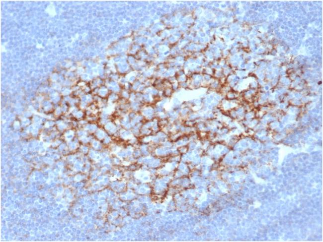 CD23 (Fc Epsilon RII) Antibody in Immunohistochemistry (Paraffin) (IHC (P))