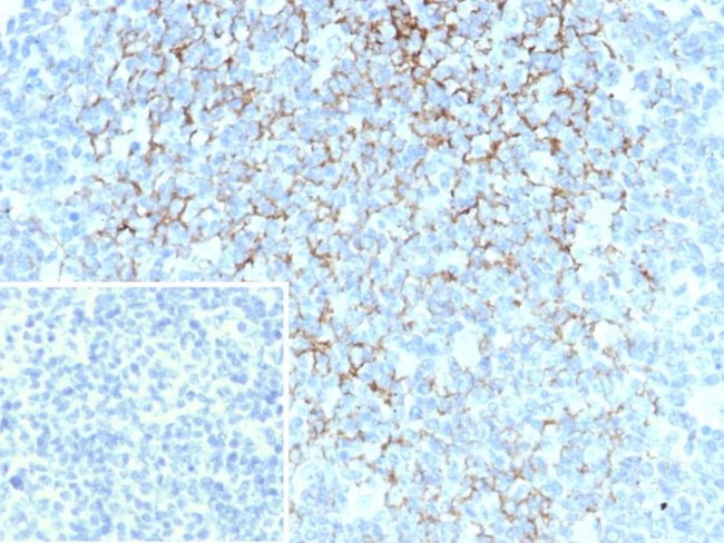 CD23 (Fc Epsilon RII) Antibody in Immunohistochemistry (Paraffin) (IHC (P))