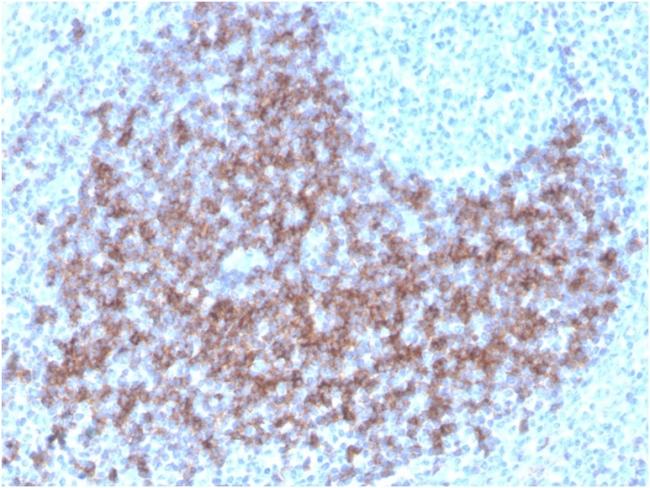 CD23 (Fc Epsilon RII) Antibody in Immunohistochemistry (Paraffin) (IHC (P))