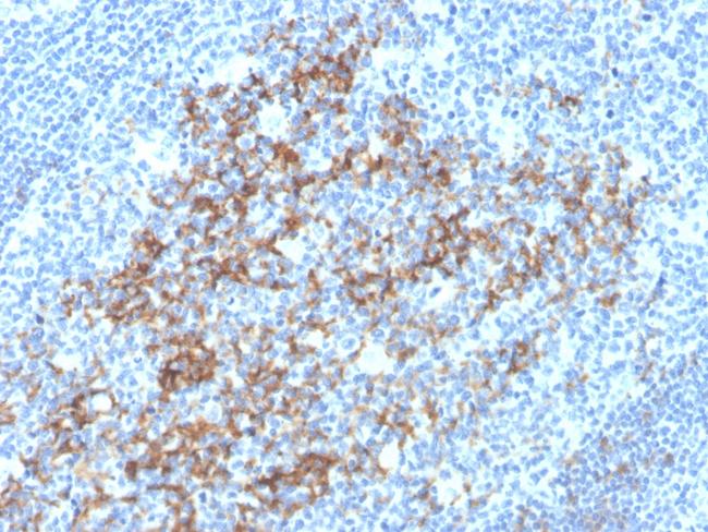 CD23 (Fc Epsilon RII) Antibody in Immunohistochemistry (Paraffin) (IHC (P))