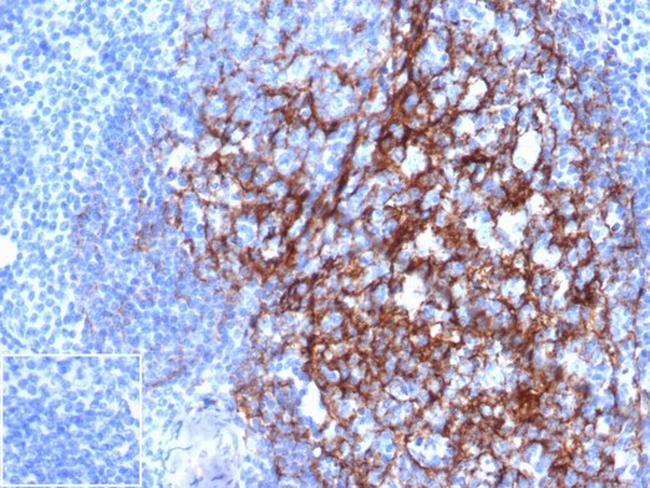 CD23 (Fc Epsilon RII) Antibody in Immunohistochemistry (Paraffin) (IHC (P))