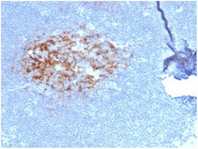 CD23 (Fc Epsilon RII) Antibody in Immunohistochemistry (Paraffin) (IHC (P))