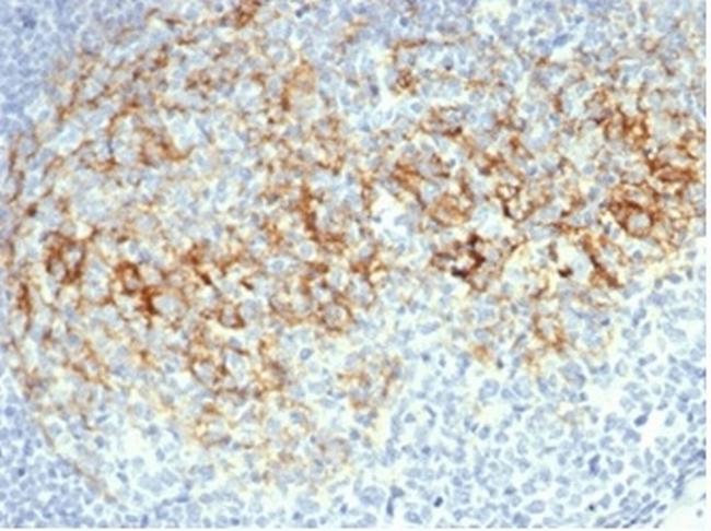 CD23 (Fc Epsilon RII) Antibody in Immunohistochemistry (Paraffin) (IHC (P))