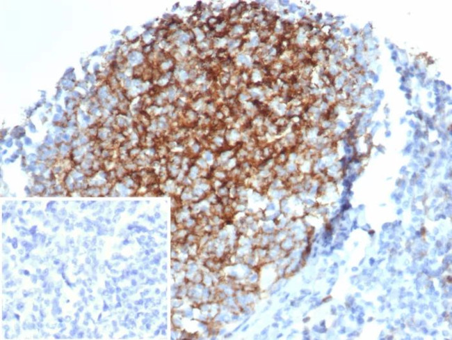 CD23 (Fc Epsilon RII) Antibody in Immunohistochemistry (Paraffin) (IHC (P))