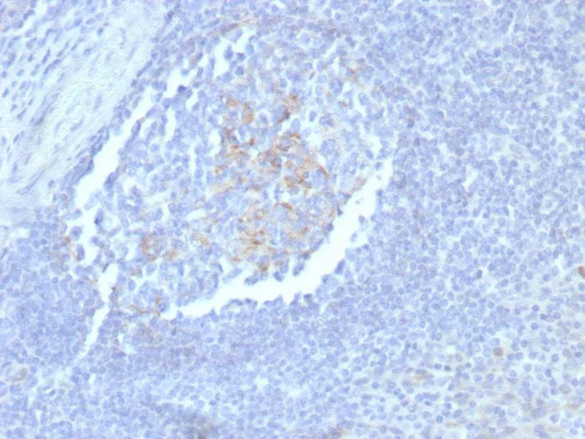 CD23 (Fc Epsilon RII) Antibody in Immunohistochemistry (Paraffin) (IHC (P))