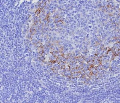 CD23 (Fc Epsilon RII) Antibody in Immunohistochemistry (Paraffin) (IHC (P))