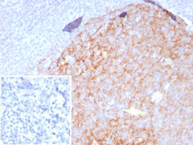 CD23 (Fc Epsilon RII) Antibody in Immunohistochemistry (Paraffin) (IHC (P))