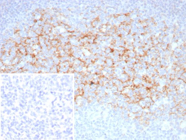 CD23 (Fc Epsilon RII) Antibody in Immunohistochemistry (Paraffin) (IHC (P))