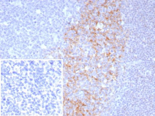 CD23 (Fc Epsilon RII) Antibody in Immunohistochemistry (Paraffin) (IHC (P))