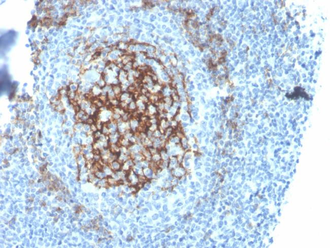 CD23 (Fc Epsilon RII) Antibody in Immunohistochemistry (Paraffin) (IHC (P))