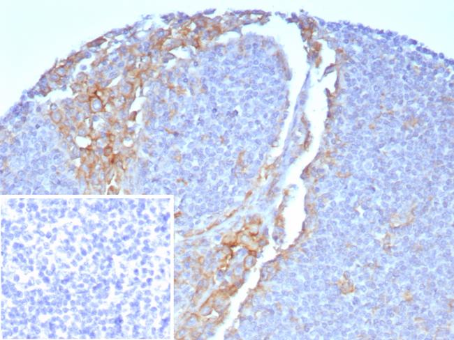 CD64/Fc gamma RI Antibody in Immunohistochemistry (Paraffin) (IHC (P))