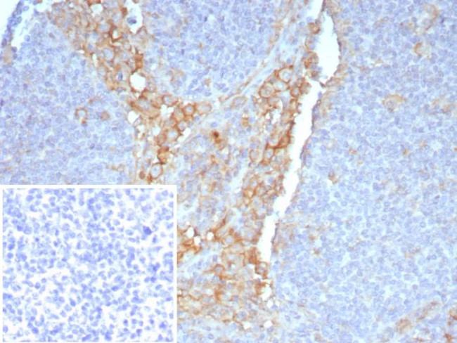 CD64/Fc gamma RI Antibody in Immunohistochemistry (Paraffin) (IHC (P))