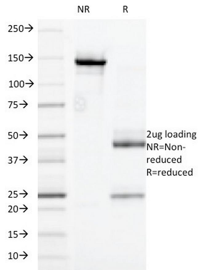 CD32 (Fc Gamma RIIa) Antibody in SDS-PAGE (SDS-PAGE)