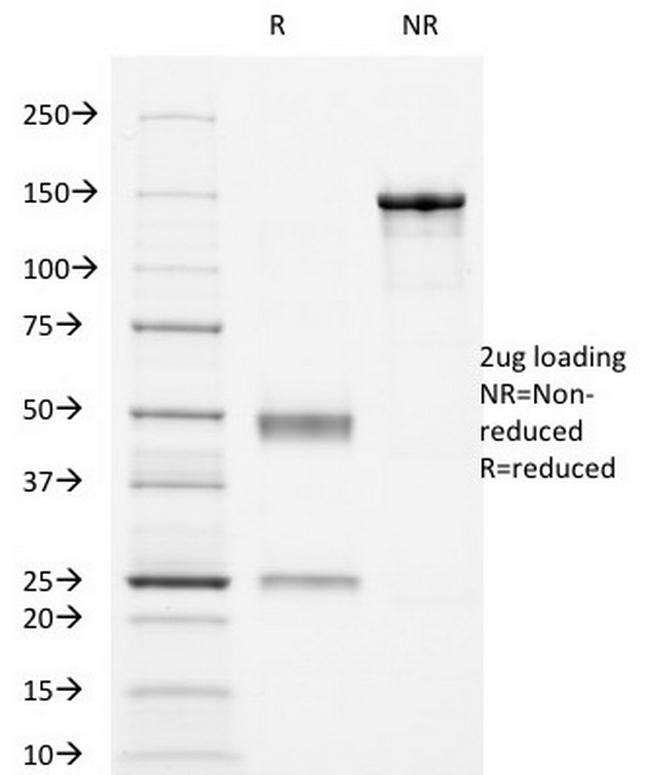 CD16/FcgammaReceptor III Antibody in SDS-PAGE (SDS-PAGE)