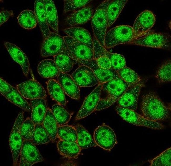 FOXI1/Forkhead Box Protein L1 (Transcription Factor) Antibody in Immunocytochemistry (ICC/IF)