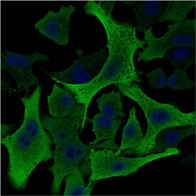 Aldo-keto Reductase Family 1 Member B1 Antibody in Immunocytochemistry (ICC/IF)