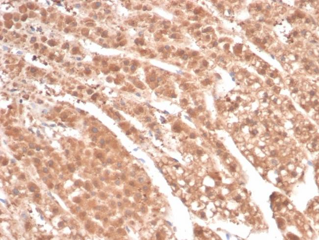 Aldo-keto Reductase Family 1 Member B1 (Adrenal Marker) Antibody in Immunohistochemistry (Paraffin) (IHC (P))