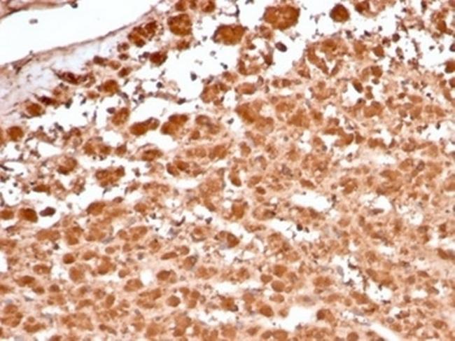 Aldo-keto Reductase Family 1 Member B1 (Adrenal Marker) Antibody in Immunohistochemistry (Paraffin) (IHC (P))