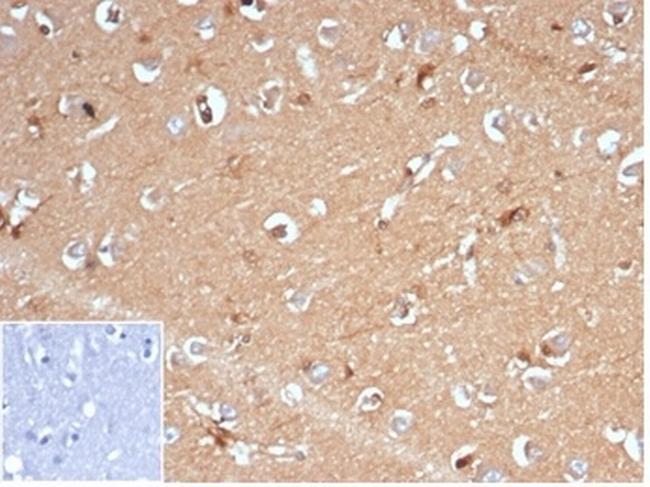 Aldo-keto Reductase Family 1 Member B1 (Adrenal Marker) Antibody in Immunohistochemistry (Paraffin) (IHC (P))