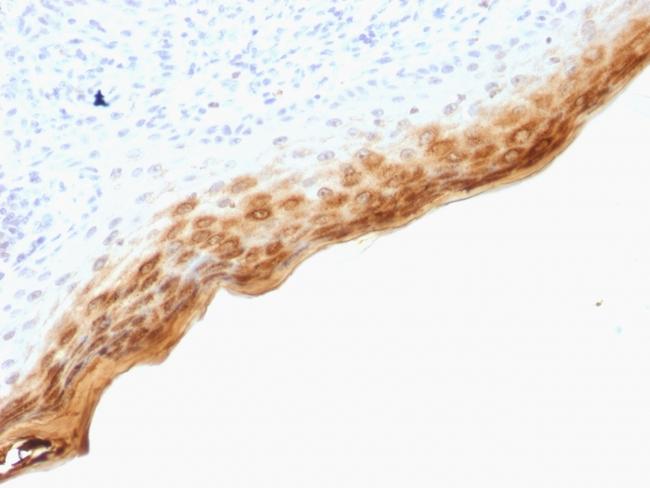 Filaggrin (Keratinocyte Differentiation Marker) Antibody in Immunohistochemistry (Paraffin) (IHC (P))